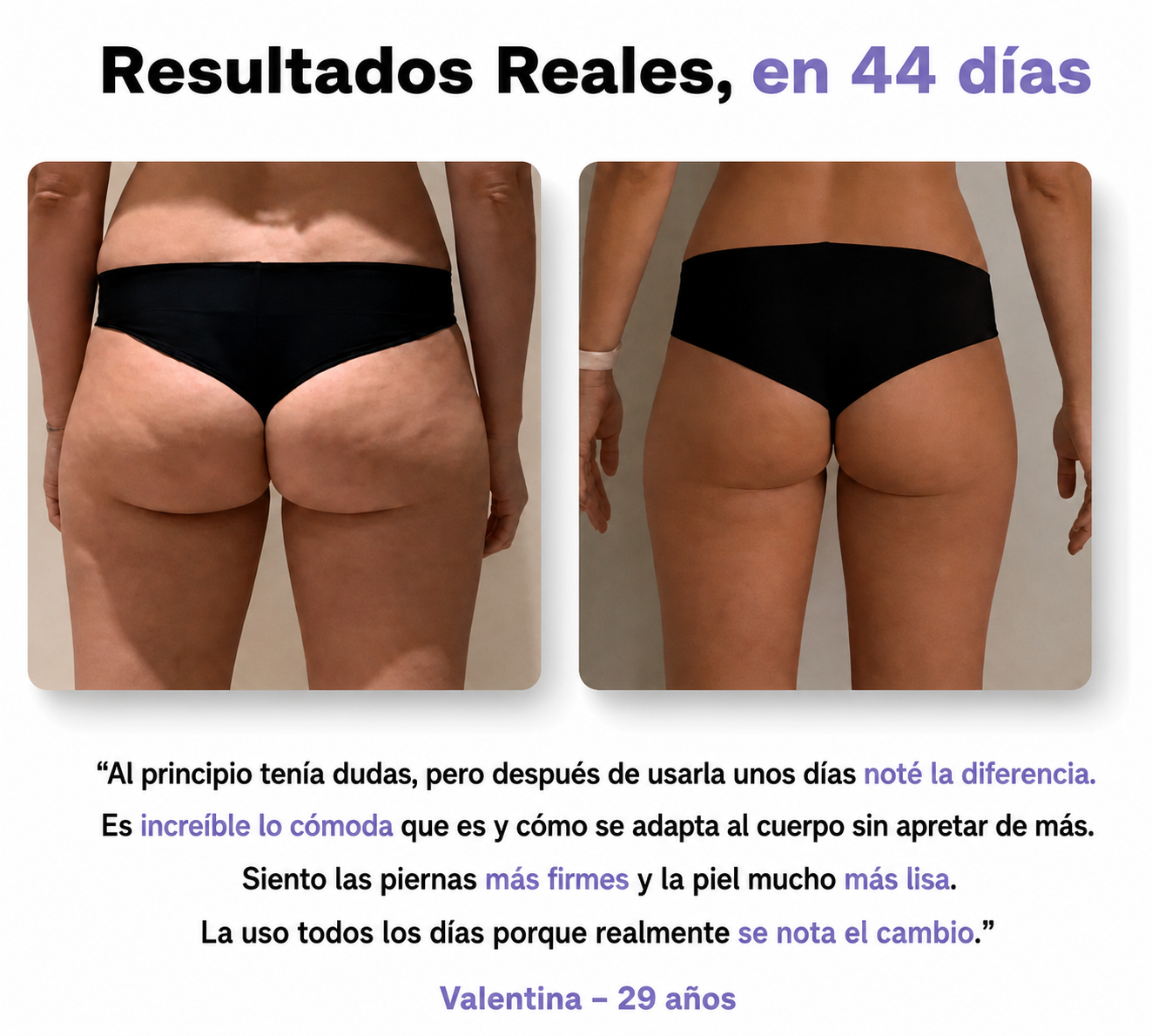 Leggings Anti-Celulitis que Realzan y Esculpen tu Figura